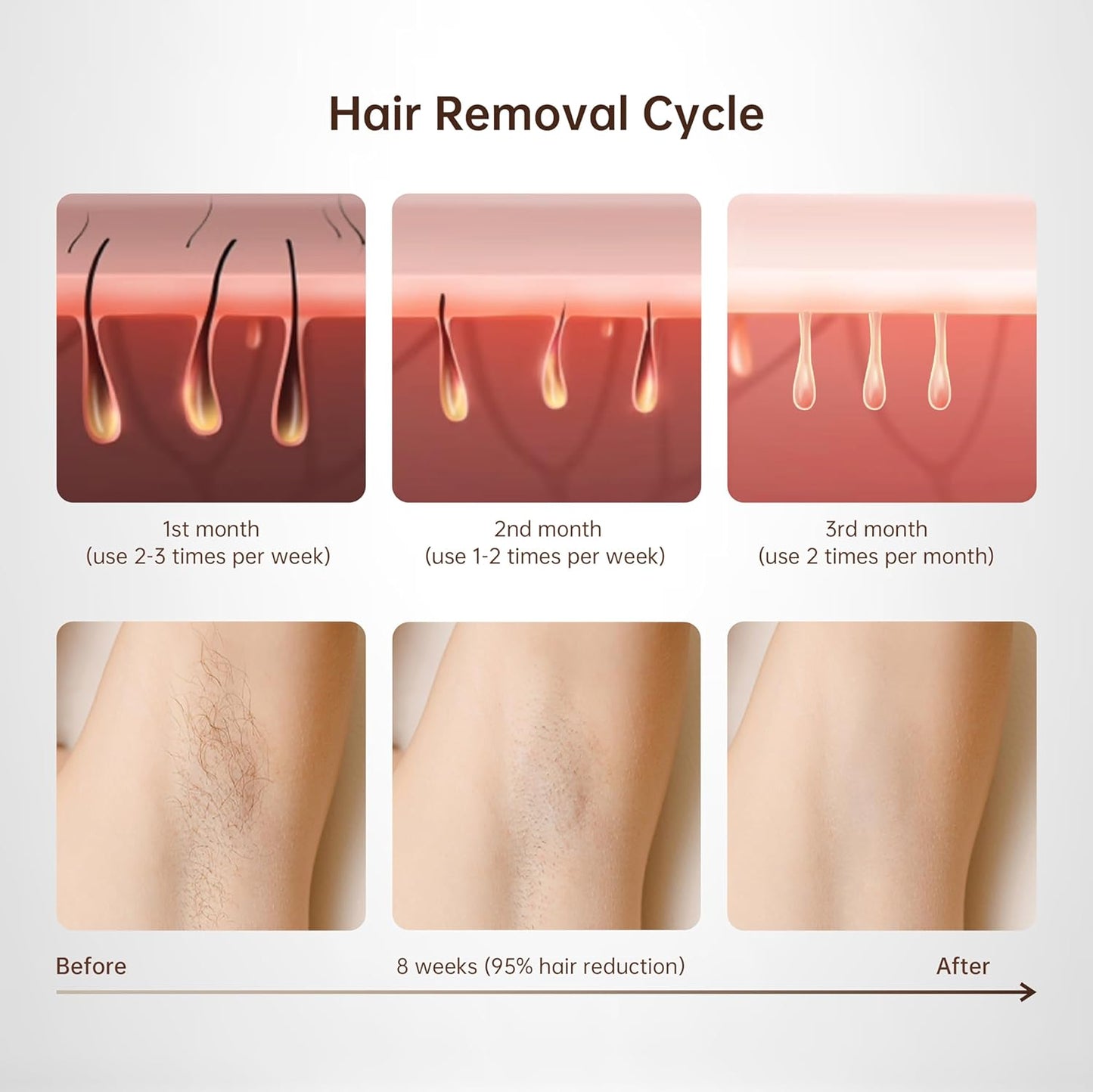 Epilator laser IPL, cu 999.900 de impulsuri luminoase, 3 moduri functionale HR/SC/RA, 9 intensitati, rapid, regenerare piele si indepartare acnee, alb