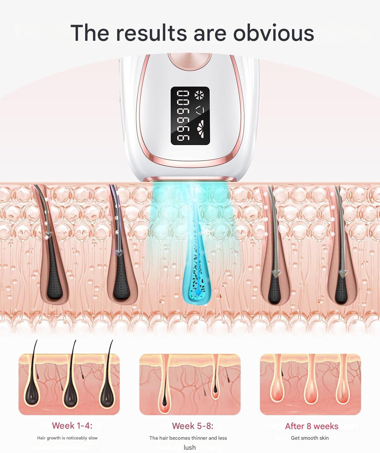 Epilator IPL cu 999.900 impulsuri, 5 niveluri de intensitate, functie racire, mod auto/manual, epliare fara durere pentru femei si barbati