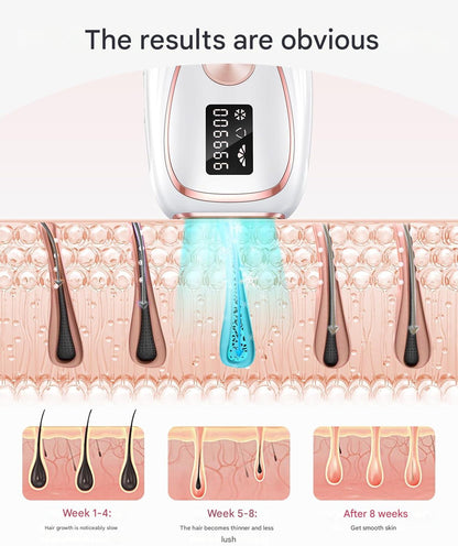 Epilator IPL cu 999.900 impulsuri, 5 niveluri de intensitate, functie racire, mod auto/manual, epliare fara durere pentru femei si barbati