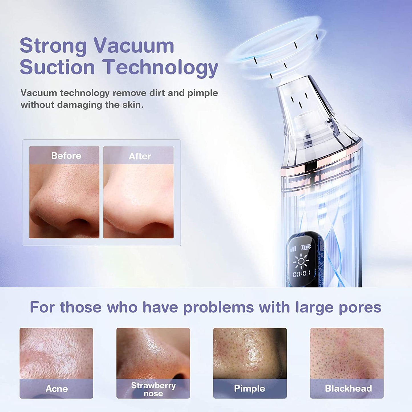 Aparat vacuum pentru indepartare puncte negre Anlan cu incarcare USB, impermeabil, 3 nivele de aspirare, cu 5 capuri de curatare interschimbabile
