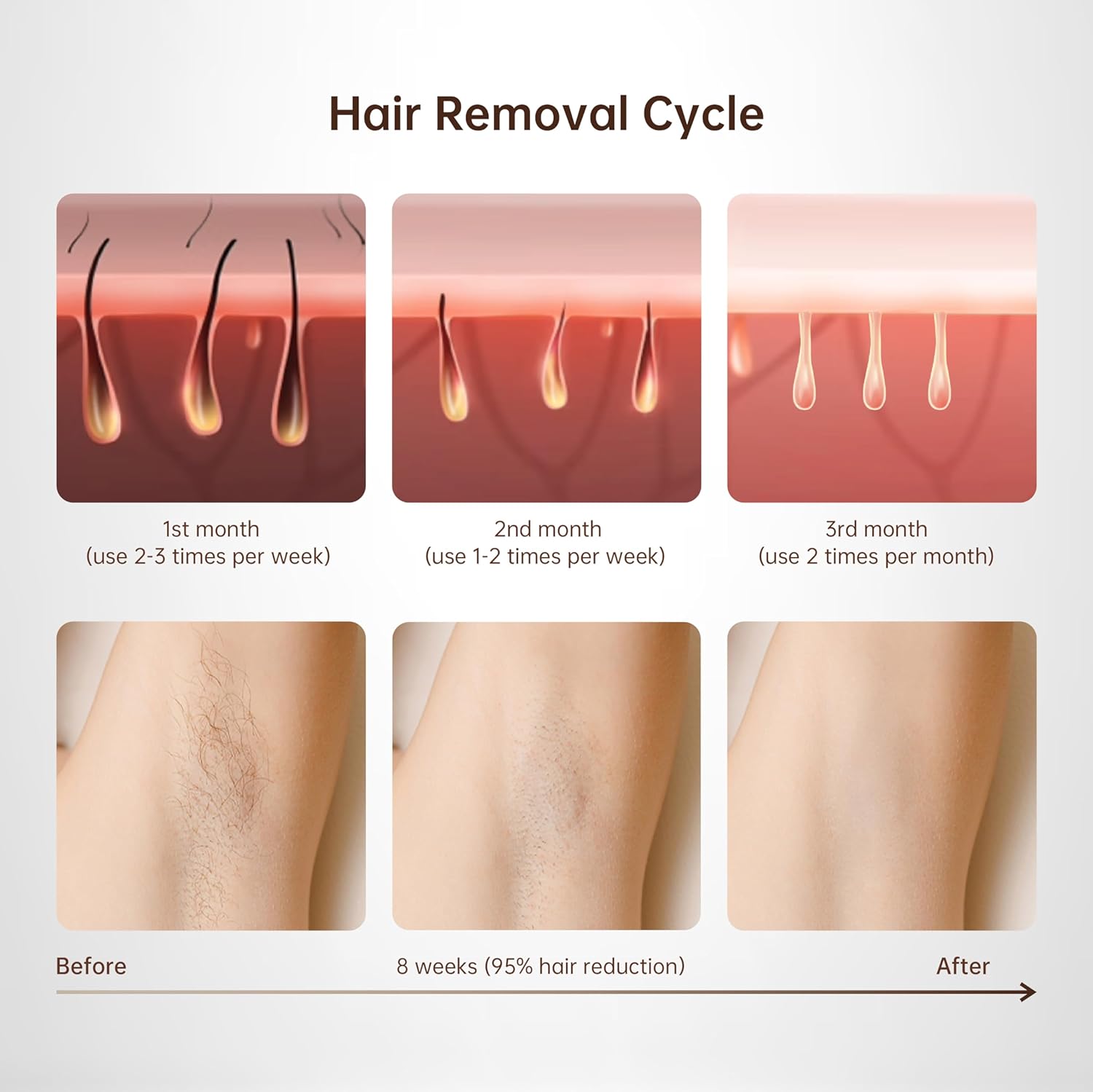 Epilator laser IPL, cu 999.900 de impulsuri luminoase, 3 moduri functionale HR/SC/RA, 9 intensitati, rapid, regenerare piele si indepartare acnee, alb