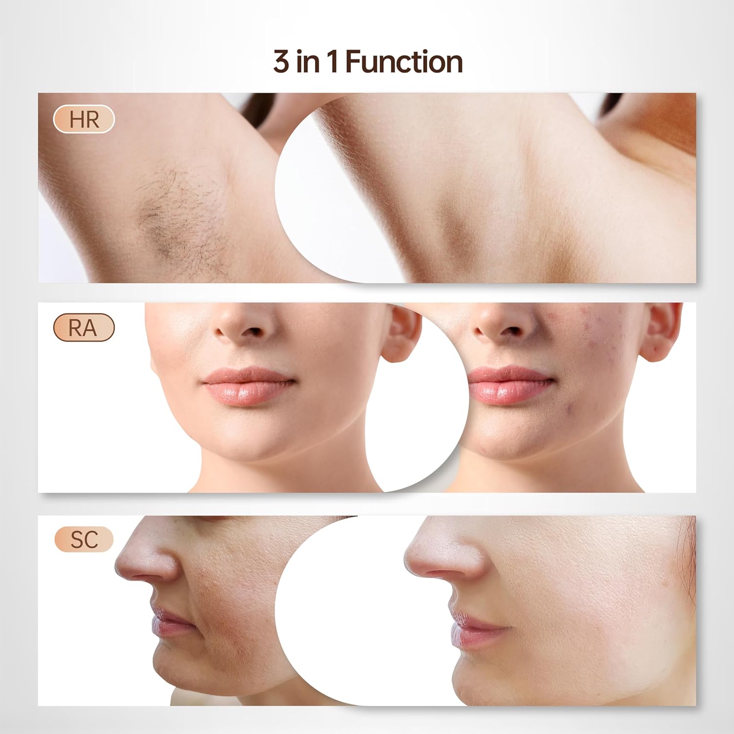 Epilator laser IPL, cu 999.900 de impulsuri luminoase, 3 moduri functionale HR/SC/RA, 9 intensitati, rapid, regenerare piele si indepartare acnee, alb