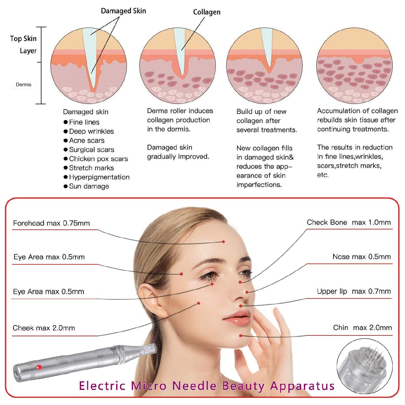 Aparat masaj facial tip stilou, dermapen, wireless, 12 capete rezerva cu 12 ace din titan, reglabil de la 0,25 la 2,5 mm, 5 trepte de intensitate, regenerarea pielii, argintiu