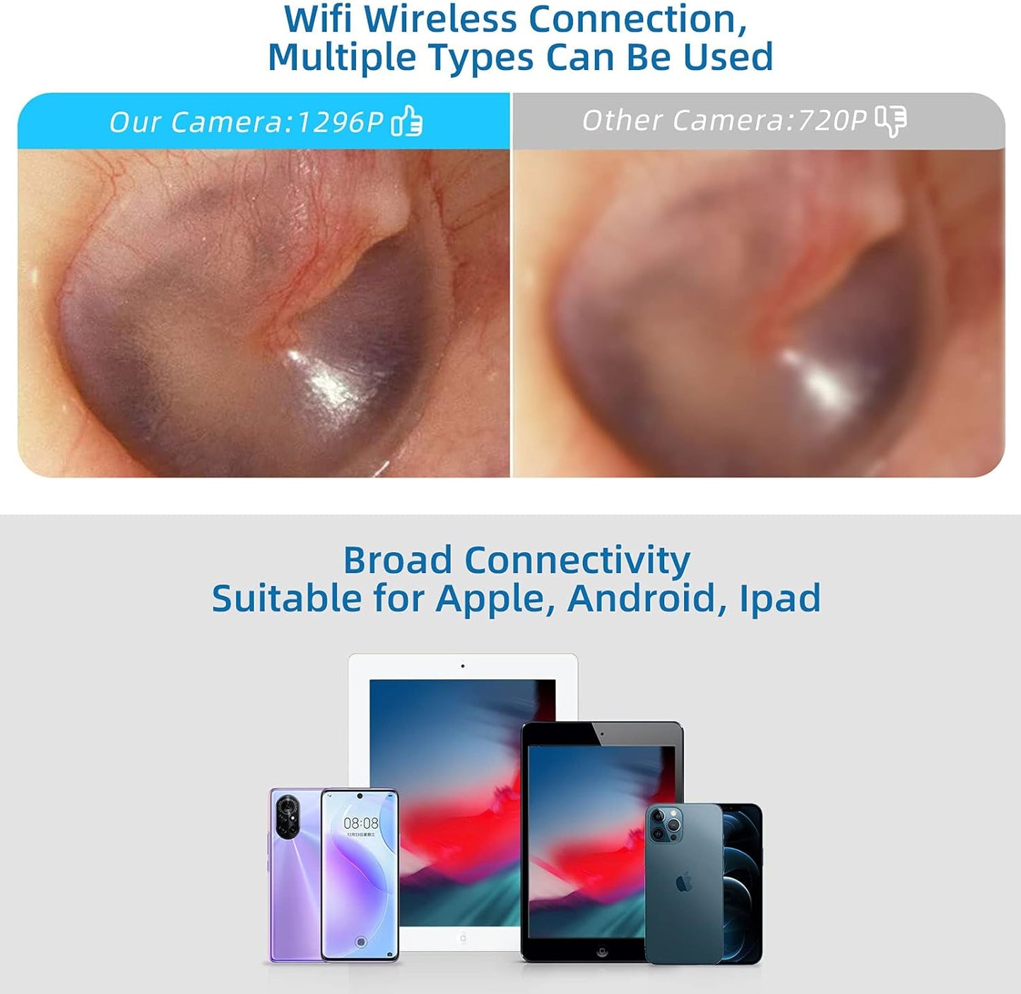 Otoscop, dispozitiv WiFi pentru indepartare ceara urechi, camera 5 MP cu lumini LED, impermeabila IP67, vizualizare live prin aplicatie Android si iOS, negru