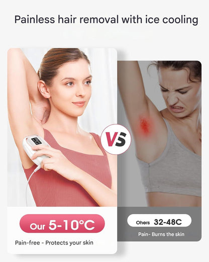 Epilator IPL cu 999.900 impulsuri, 5 niveluri de intensitate, functie racire, mod auto/manual, epliare fara durere pentru femei si barbati