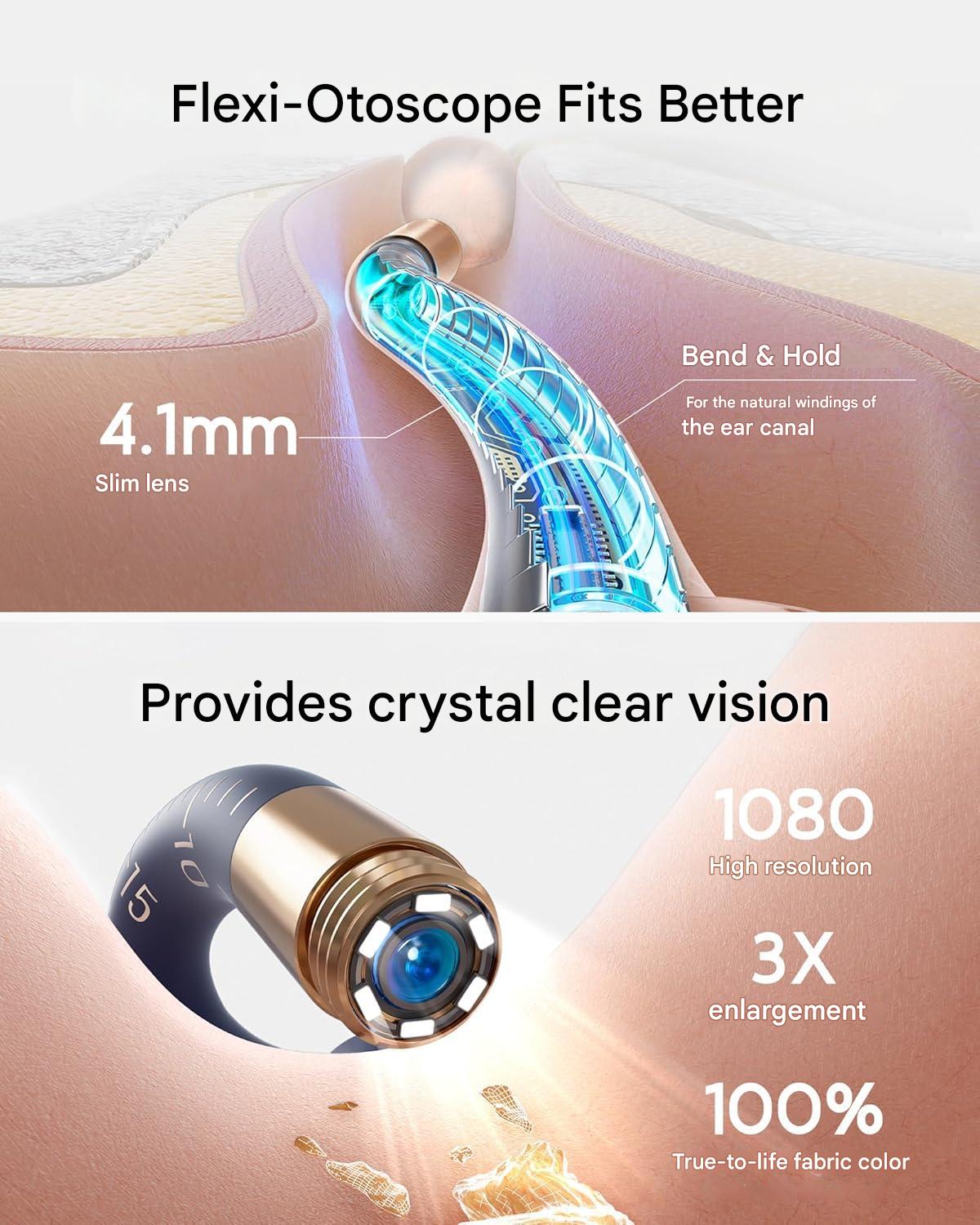 Otoscop pentru indepartare ceara urechi, camera HD flexibila pentru urechi/nas/gat, cu lumini LED, pensete, aplicatie smartphone si accesorii, pentru copii si adulti