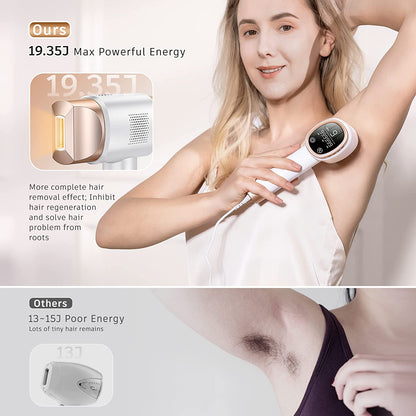 Epilator laser IPL, cu 999.999 de impulsuri luminoase, 3 moduri functionale HR/SC/RA, 9 intensitati, rapid, regenerare piele si indepartare acnee, Aminzer
