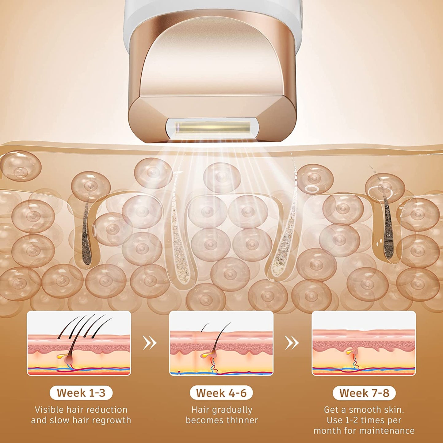 Epilator laser IPL, cu 999.999 de impulsuri luminoase, 3 moduri functionale HR/SC/RA, 9 intensitati, rapid, regenerare piele si indepartare acnee, Aminzer