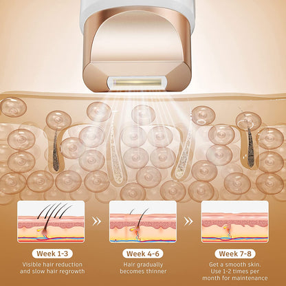 Epilator laser IPL, cu 999.999 de impulsuri luminoase, 3 moduri functionale HR/SC/RA, 9 intensitati, rapid, regenerare piele si indepartare acnee, Aminzer